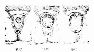 全程直击分娩子宫变化