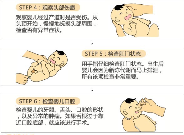 新生兒做體檢 父母只需記住3個(gè)數(shù)