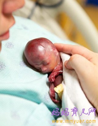 美国妈妈产下19周早产儿 看着就揪心（图片）