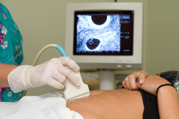 【情】怀孕两个月听不到胎心正常吗 最晚多少天有胎心胎芽