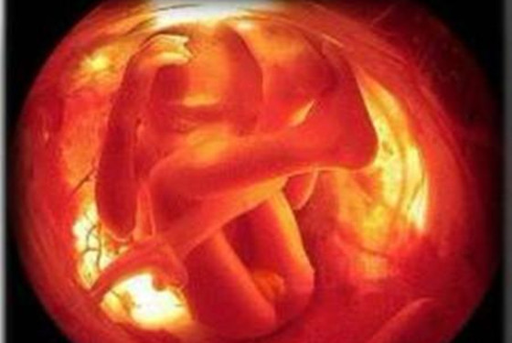 【情】怀孕四个月的胎儿有多大 3张B超图