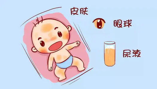 婴儿黄疸消退只用四招