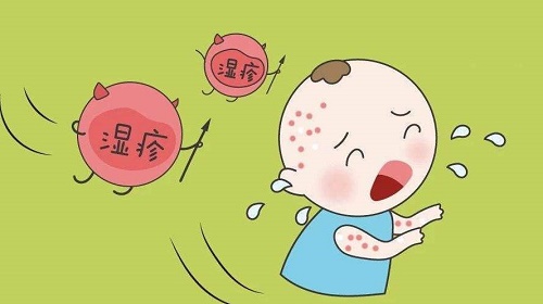 宝宝湿疹的快速缓解方法有哪些 教你如何快速缓解宝宝湿疹