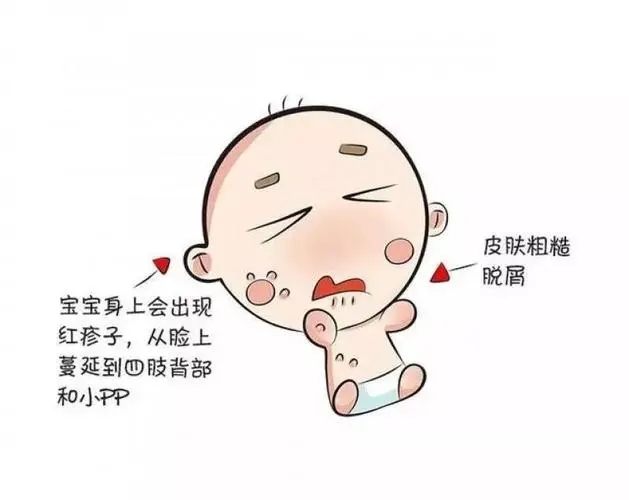 宝宝湿疹的快速缓解方法有哪些 教你如何快速缓解宝宝湿疹