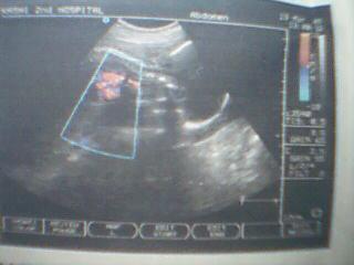 怀孕7个月胎儿图 怀孕7个月胎儿B超图