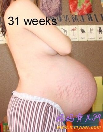 图片解秘三胞胎母亲的怀孕全过程