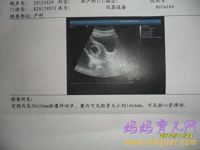 孕囊大小对照表 一表读懂孕囊形状的玄机