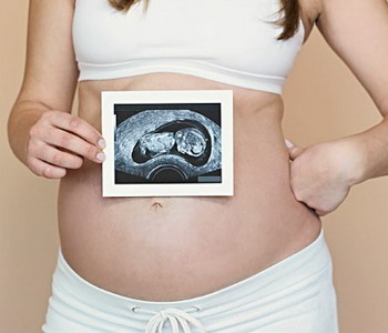 胎心率与宝宝性别  看胎心监护可分辨男孩女孩吗