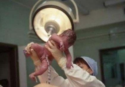 一位顺产妈妈分娩全过程图片