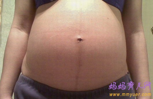 看妊娠纹判断生男生女超准 生儿子的妊娠线图片