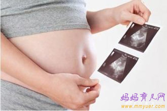 孕期做四维彩超多少钱 四维彩超是检查什么？