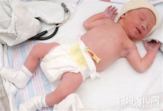 新生儿脐带护理三原则 步步为营的新生儿脐部护理巧