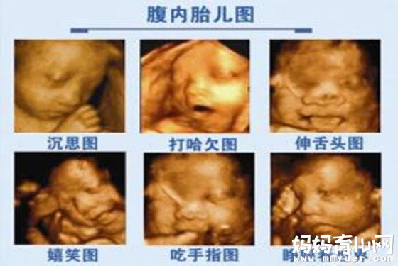 怀孕八个月胎儿彩超图 吃手指、打哈欠模样萌
