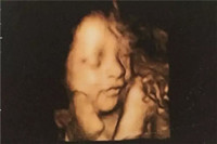 怀孕六十天胎儿图片图片