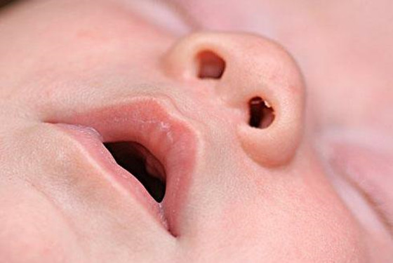 初生婴儿鼻塞 喉咙响 鼻子呼哧呼哧的居然是.
