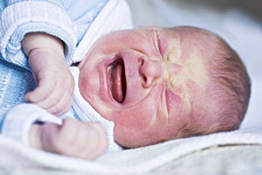 宝宝出生不哭是什么原因 多半是这4点造成的