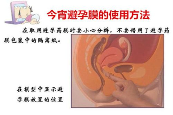 避孕膜 月经图片