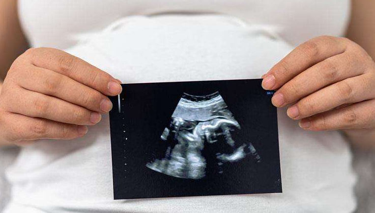 一个月胎儿有多大图片