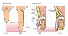 孕育知识：男性生殖系统全面解析