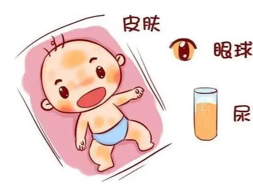 新生婴儿黄疸多少算正常，告诉你正确的新生儿黄疸值多少正常