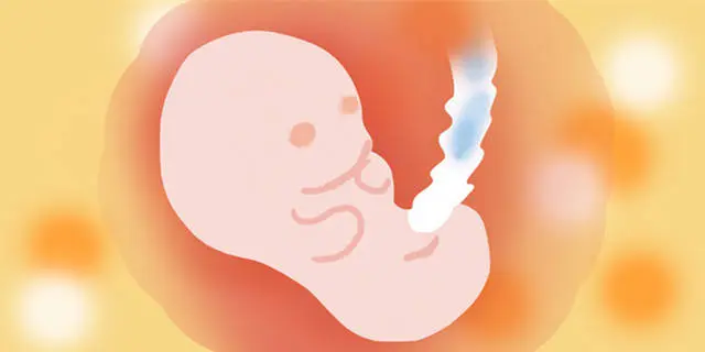 五大原因造成胎儿畸形