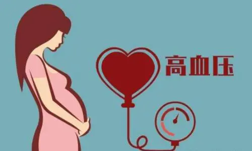 孕妇血压170要终止妊娠吗