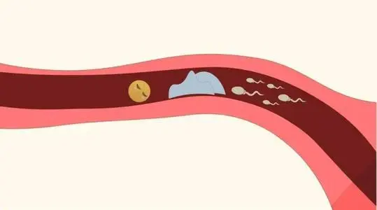 输卵管堵塞有哪些症状表现 输卵管堵塞的5个征兆！