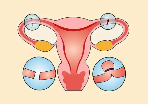 输卵管自测9种方法，教你怎么在家自测输卵管是否通畅