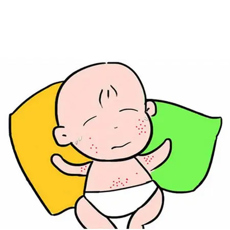 新生儿痱子和湿疹的区别，婴儿湿疹与痱子对比照