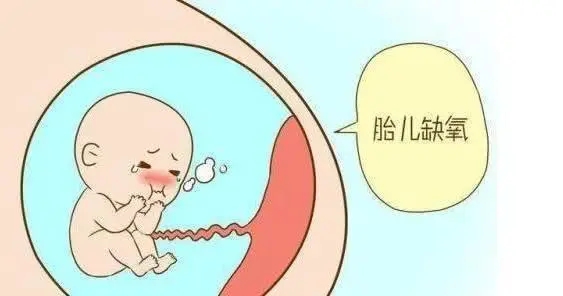 孕妇怎样避免胎儿缺氧