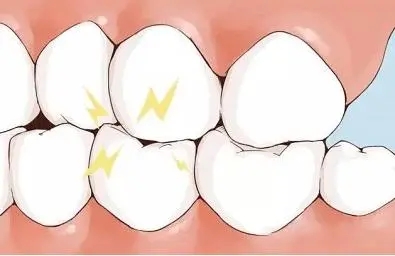 快速消除磨牙的八个方法