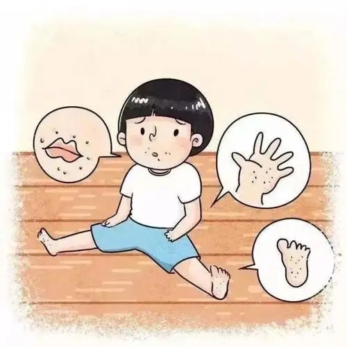 手足口会危险孩子的哪些健康安全？痊愈后会不会对身体造成不可逆转的伤害？
