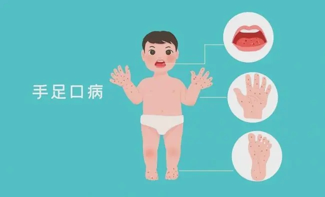 关于儿童常见的手足口病，你到底了解多少？